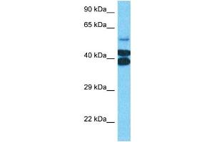 Host:  Rabbit  Target Name:  PTOV1  Sample Type:  Jurkat Whole Cell lysates  Antibody Dilution:  0. (PTOV1 anticorps  (N-Term))