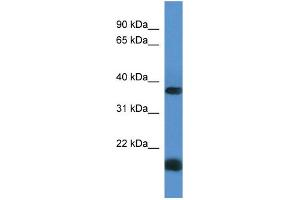Western Blotting (WB) image for anti-Rhomboid Domain Containing 1 (RHBDD1) (C-Term) antibody (ABIN2788470) (RHBDD1 anticorps  (C-Term))