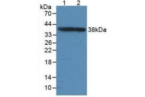 Figure. (GAP43 anticorps  (AA 8-226))