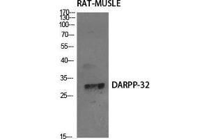 Western Blot (WB) analysis of specific cells using DARPP-32 Polyclonal Antibody. (DARPP32 anticorps  (Tyr785))