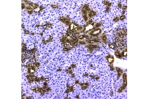 IHC analysis of 14-3-3 zeta/delta using anti-14-3-3 zeta/delta antibody . (14-3-3 zeta anticorps)