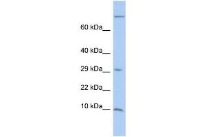 WB Suggested Anti-MGP Antibody Titration:  0. (MGP anticorps  (Middle Region))