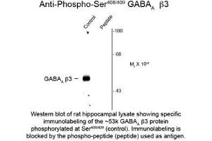 Image no. 1 for anti-gamma-aminobutyric Acid (GABA) A Receptor, beta 2 (GABRB2) (pSer408), (Ser409) antibody (ABIN956760) (GABRB2 anticorps  (pSer408, Ser409))