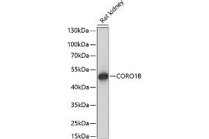 Western blot analysis of extracts of rat kidney, using CORO1B antibody (ABIN7266507) at 1:1000 dilution. (CORO1B anticorps  (AA 380-489))