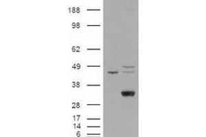 Western blot analysis of LIPG in cell lysates that were transfected with the pCMV6-ENTRY control or pCMV6-ENTRY LIPG cDNA using LIPG polyclonal antibody . (LIPG anticorps  (C-Term))