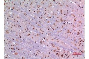 Immunohistochemistry (IHC) analysis of paraffin-embedded Rat Brain, antibody was diluted at 1:100.