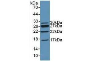 Detection of Recombinant CHD3, Mouse using Polyclonal Antibody to Chromodomain Helicase DNA Binding Protein 3 (CHD3) (CHD3 anticorps  (AA 1613-1820))