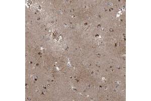Immunohistochemical staining of human lateral ventricle with SFMBT2 polyclonal antibody  shows strong cytoplasmic positivity in neuronal cells at 1:200-1:500 dilution. (SFMBT2 anticorps)