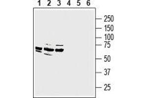 Western blot analysis of rat dorsal root ganglion lysate (lanes 1 and 4), mouse (lanes 2 and 5) and rat (lanes 3 and 6) brain membranes: - 1-3. (MRGPRE anticorps  (3rd Intracellular Loop))