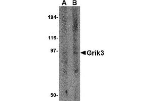 Western Blotting (WB) image for anti-Glutamate Receptor, Ionotropic, Kainate 3 (GRIK3) (N-Term) antibody (ABIN1031396) (GRIK3 anticorps  (N-Term))