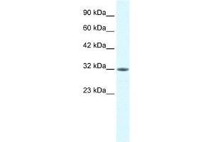 WB Suggested Anti-MORF4L2 Antibody Titration:  0. (MORF4L2 anticorps  (N-Term))