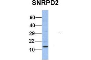 Host:  Rabbit  Target Name:  SNRPD2  Sample Type:  Human MCF7  Antibody Dilution:  1. (SNRPD2 anticorps  (Middle Region))