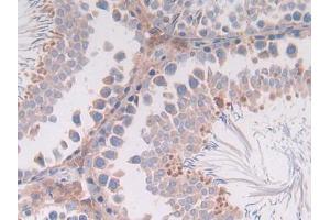 DAB staining on IHC-P; Samples: Rat Intestine Tissue (IL-4 anticorps  (AA 61-111))