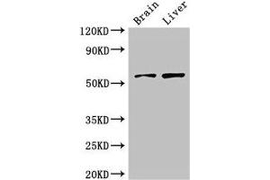 Western Blot Positive WB detected in: Mouse brain tissue, Rat liver tissue All lanes: KCNA1 antibody at 3 μg/mL Secondary Goat polyclonal to rabbit IgG at 1/50000 dilution Predicted band size: 57 kDa Observed band size: 57 kDa (KCNA1 anticorps  (AA 7-150))