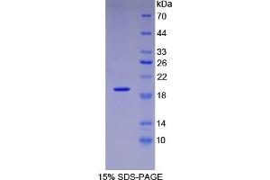 SDS-PAGE of Protein Standard from the Kit (Highly purified E.