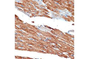 Immunohistochemistry of paraffin-embedded rat heart using NDUFB8 Rabbit mAb (ABIN7268813) at dilution of 1:100 (40x lens). (NDUFB8 anticorps)