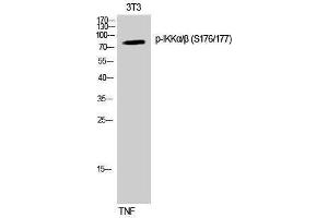 Western Blotting (WB) image for anti-IKK-alpha /IKK-beta (pSer176), (pSer177) antibody (ABIN3182040) (IKK-alpha /IKK-beta anticorps  (pSer176, pSer177))