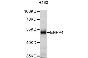 Western blot analysis of extracts of H460 cells, using ENPP4 antibody (ABIN5972569) at 1:3000 dilution. (ENPP4 anticorps)