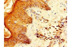 Immunohistochemistry of paraffin-embedded human skin tissue using ABIN7142567 at dilution of 1:100