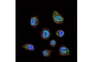 Confocal immunofluorescent analysis of HIF-1 alpha antibody with MDA-MB231 cells followed by Alexa Fluor 488-conjugated goat anti-rabbit lgG (green).