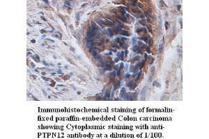 Image no. 1 for anti-Protein Tyrosine Phosphatase G1 (PTPN12) antibody (ABIN791170) (PTPN12 anticorps)