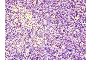 Immunohistochemistry of paraffin-embedded human thymus tissue using ABIN7167020 at dilution of 1:100 (RACGAP1 anticorps  (AA 86-331))