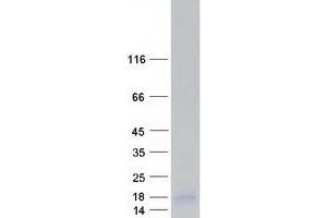 Validation with Western Blot