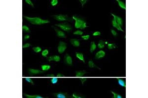 Immunofluorescence analysis of A549 cells using AIRE Polyclonal Antibody (AIRE anticorps)