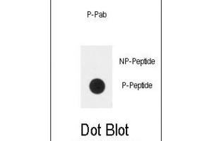 Dot Blot (DB) image for anti-Plexin D1 (PLXND1) (pTyr1642) antibody (ABIN3001877) (PLXND1 anticorps  (pTyr1642))