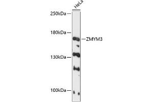 Western blot analysis of extracts of HeLa cells, using ZMYM3 antibody (ABIN6128940, ABIN6150453, ABIN6150454 and ABIN6216809) at 1:3000 dilution. (ZMYM3 anticorps  (AA 140-300))