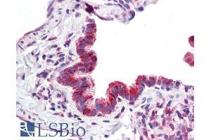 anti-Mitochondrial Calcium Uptake 1 (MICU1) (AA 113-126) antibody