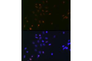 Immunofluorescence analysis of NIH/3T3 cells using SUPT5H/SPT5 Rabbit mAb (ABIN7270878) at dilution of 1:100 (40x lens). (SUPT5H anticorps)
