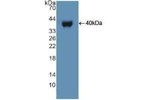 Western blot analysis of recombinant Human UBE3A. (ube3a anticorps  (AA 158-407))