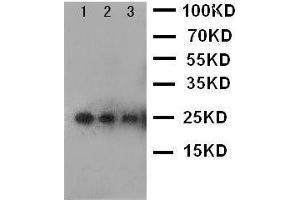 Anti-VEGF antibody, Western blotting Lane 1: Recombinant Human VEGF Protein 10ng Lane 2: Recombinant Human VEGF Protein 5ng Lane 3: Recombinant Human VEGF Protein 2. (VEGFA anticorps  (N-Term))