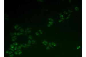 Figure. (HCCS anticorps  (AA 1-268))