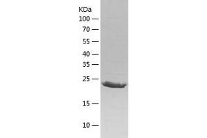 Western Blotting (WB) image for Glutathione S-Transferase pi 1 (GSTP1) (AA 1-210) protein (His-IF2DI Tag) (ABIN7123149)