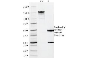 SDS-PAGE Analysis Purified Vimentin Mouse Monoclonal Antibody (VM452).