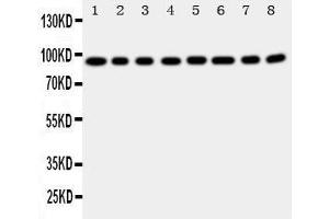 Western Blotting (WB) image for anti-Coagulation Factor VIII (F8) (AA 1264-1278), (Middle Region) antibody (ABIN3042924) (Factor VIII anticorps  (Middle Region))