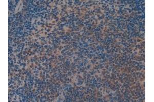 Detection of MAP2K2 in Mouse Spleen Tissue using Polyclonal Antibody to Mitogen Activated Protein Kinase Kinase 2 (MAP2K2)