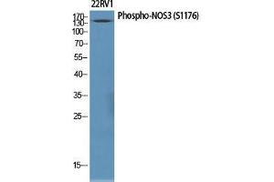Western Blot (WB) analysis of specific cells using Phospho-NOS3 (S1177) Polyclonal Antibody. (ENOS anticorps  (pSer1177))