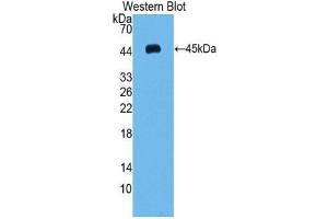 Western blot analysis of the recombinant protein. (VEGFC anticorps  (AA 47-413))