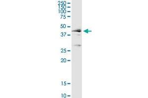 CTSD MaxPab rabbit polyclonal antibody. (Cathepsin D anticorps  (AA 1-412))