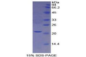 SDS-PAGE analysis of Human Protein S Protein. (PROS1 Protéine)