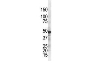 The IKK gamma antibody used in western blot to detect IKKg in ZR75-1 cell lysate.