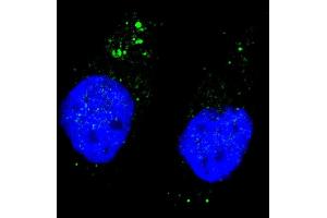 Fluorescent image of  cells stained with ULK1 (phospho ) antibody. (ULK1 anticorps  (pSer556))