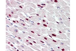 Anti-THAP5 antibody IHC of human heart. (THAP5 anticorps  (AA 203-252))