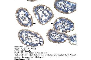 Rabbit Anti-NUDT21 Antibody  Paraffin Embedded Tissue: Human Intestine Cellular Data: Epithelial cells of intestinal villas Antibody Concentration: 4.