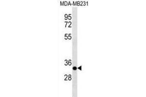 Western Blotting (WB) image for anti-Calpain, Small Subunit 2 (CAPNS2) antibody (ABIN3000891) (CAPNS2 anticorps)
