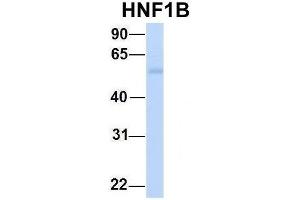 Host:  Rabbit  Target Name:  HNF1B  Sample Type:  Human Fetal Muscle  Antibody Dilution:  1.