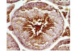 Mouse testis tissue was stained by rabbit Anti-Desnutrin (296-318) (Mouse) Serum (PNPLA2 anticorps  (AA 296-318))